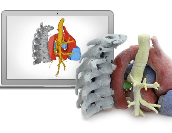 HT médica - Programa i+d+i - Impresión 3D