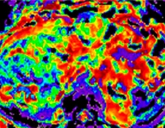 HT médica - Programa i+d+i - resonancia magnética