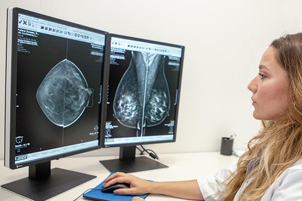 HT médica - Mamografía 3D